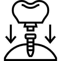 Implanty stomatologiczne